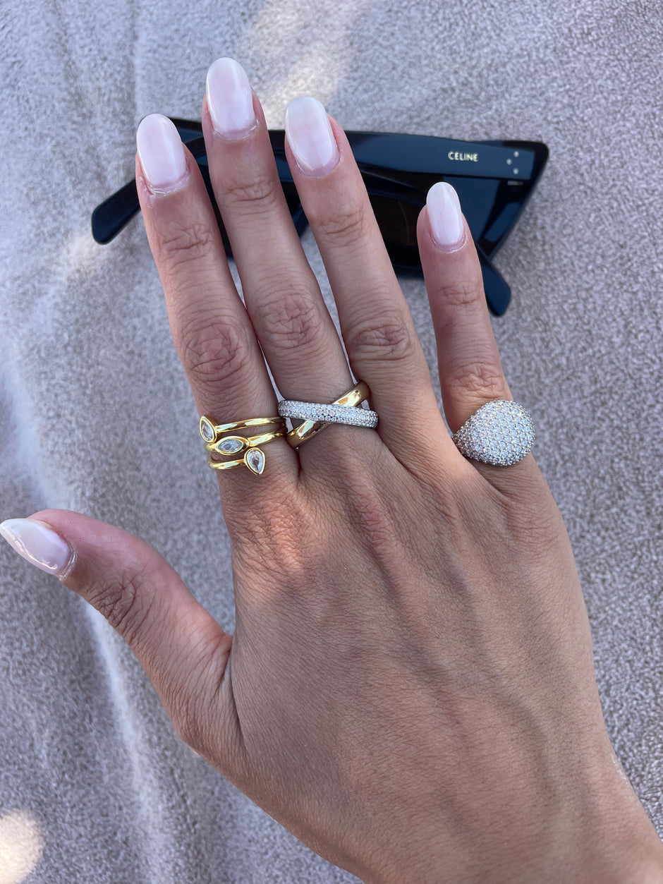 Anello  Ics
